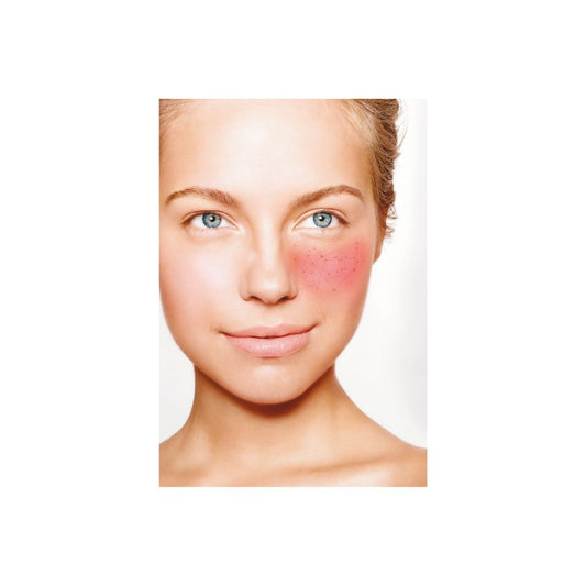 BioNike DEFENCE TOLERANCE Upokojujúca starostlivosť o očné okolie, 15 ml